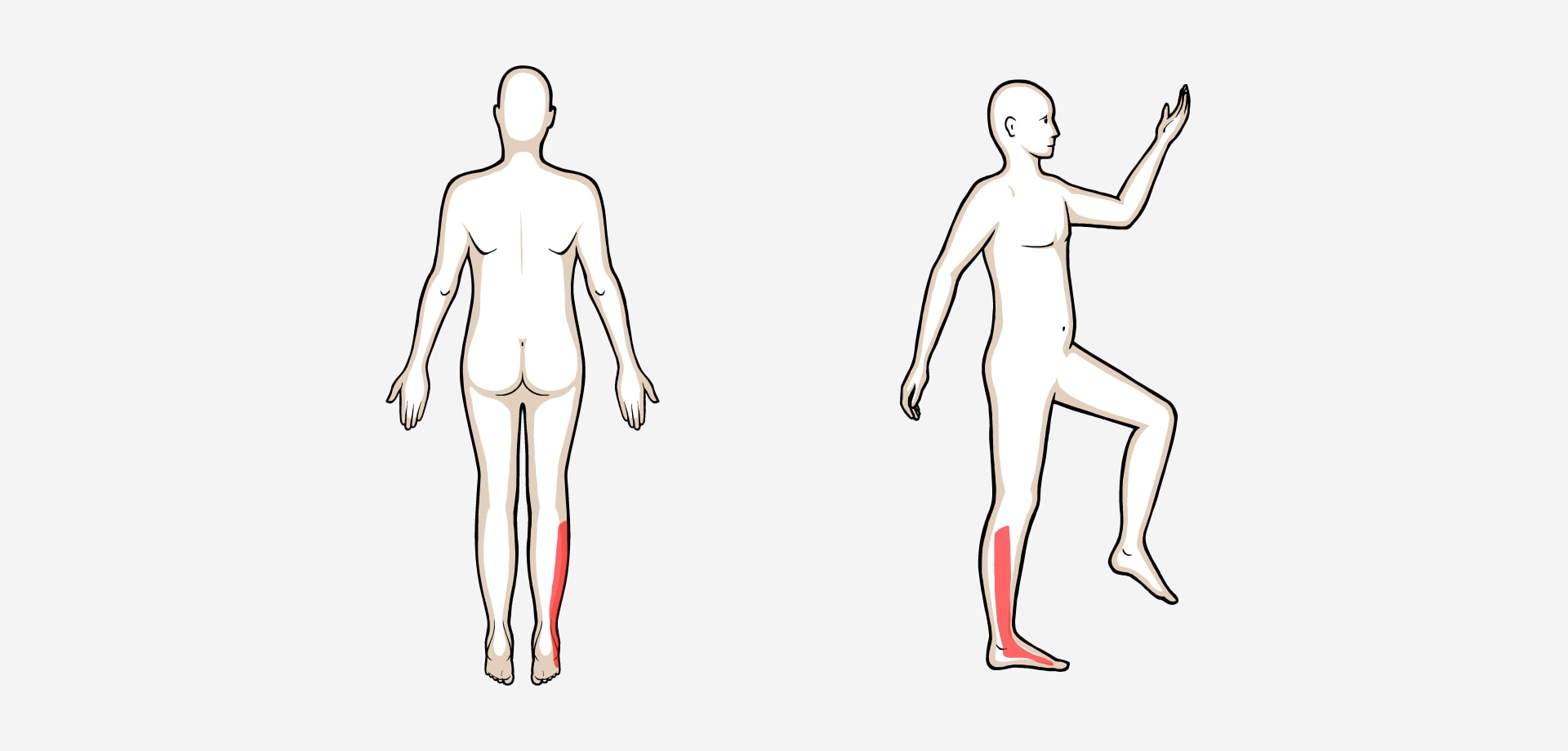 Dolor lateral rodilla y pierna